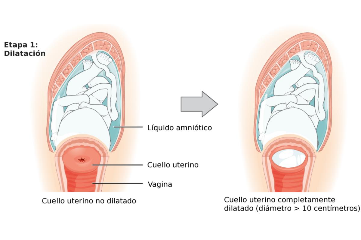 Cómo dilatar más rápido en el parto