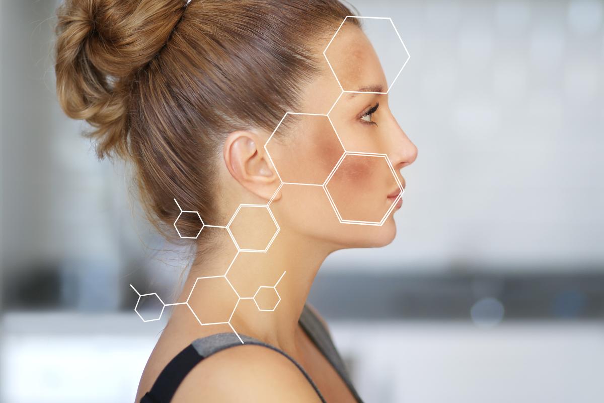 Remedios caseros para quitar las manchas de la cara