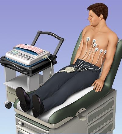 Cómo se hace un electrocardiograma