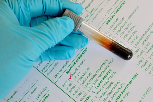 Cómo prevenir enfermedades renales - Mantén unos niveles de glucosa adecuados 