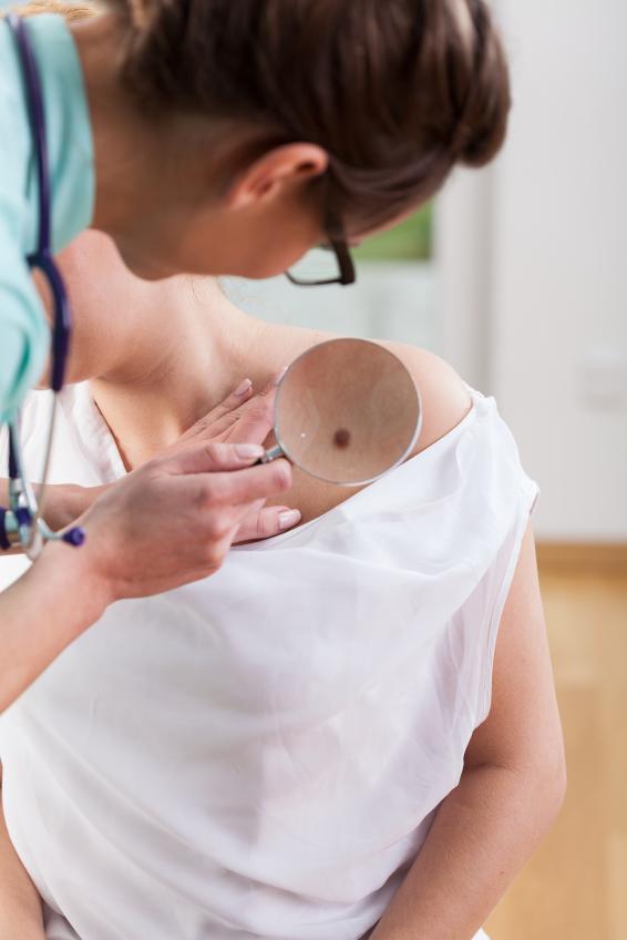 Cómo usar la miel para quitar lunares - Paso 2