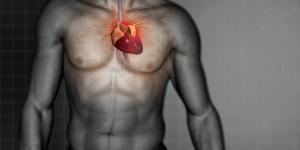 Factores de riesgo del infarto de miocardio