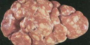 Cómo tratar la nefritis