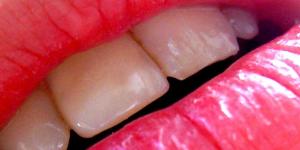 Cómo eliminar la placa en los dientes