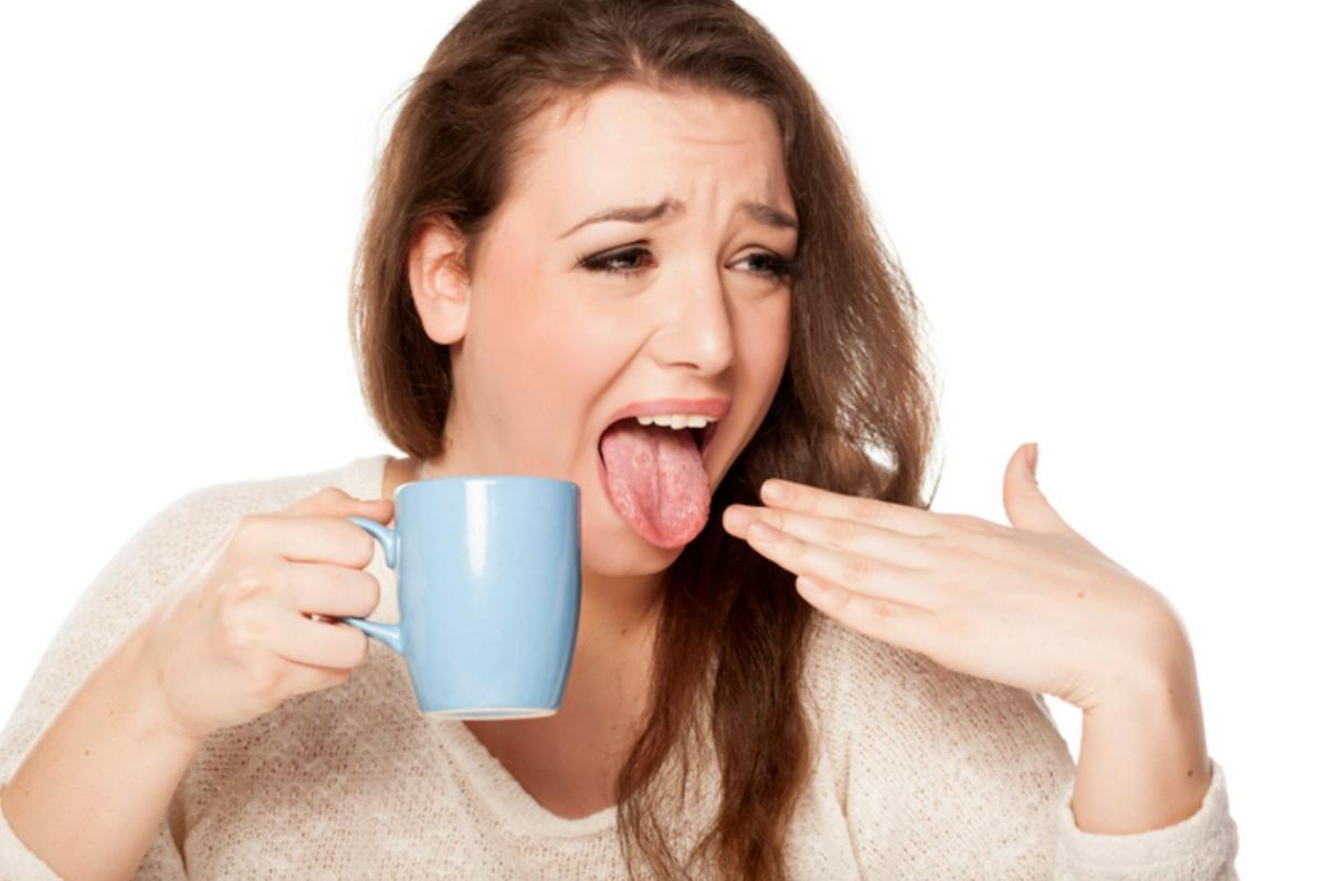 Cómo quitar lo escaldado de la lengua