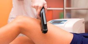 Cómo funciona la fotodepilación