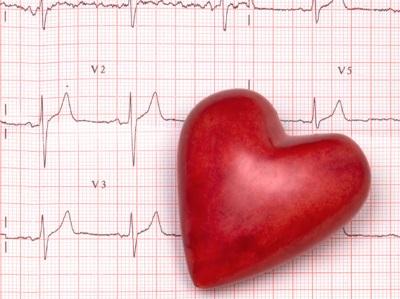 Cómo reconocer el infarto agudo de miocardio