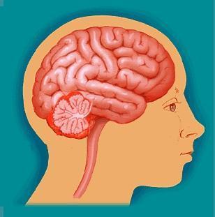 Cómo se trata un síncope por hipotensión ortostática