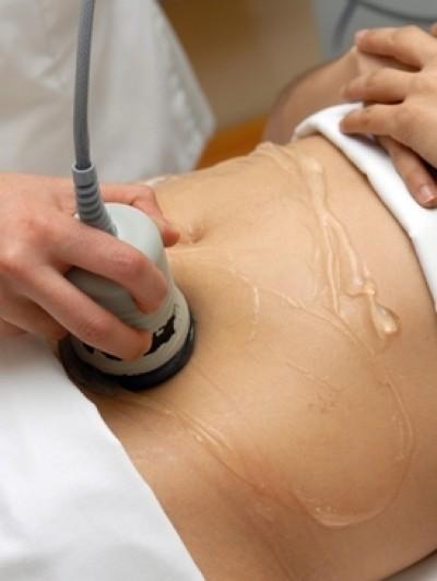 Cómo funciona la cavitación