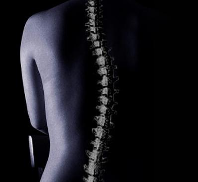 Cómo detectar la escoliosis