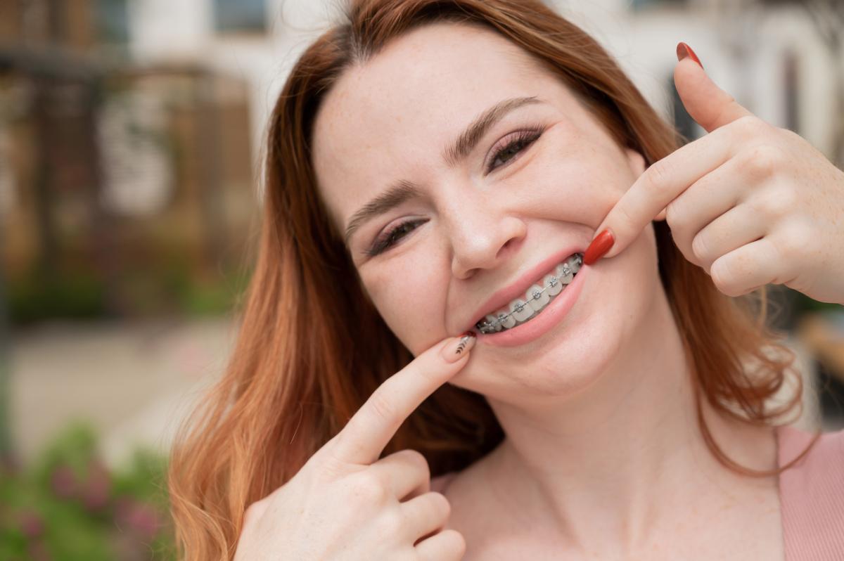 Tips para sonreír con brackets