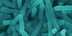 Cómo diagnosticar listeriosis