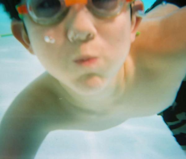 Cómo destapar los oídos después de nadar