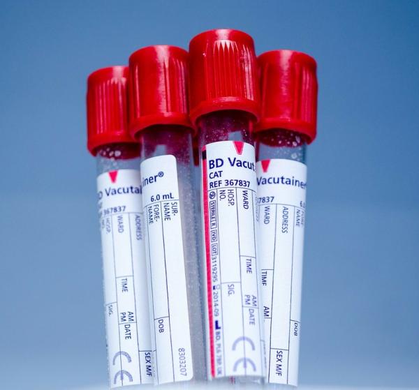 Por qué sube el potasio