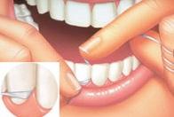 Cómo usar el hilo dental correctamente - Paso 5