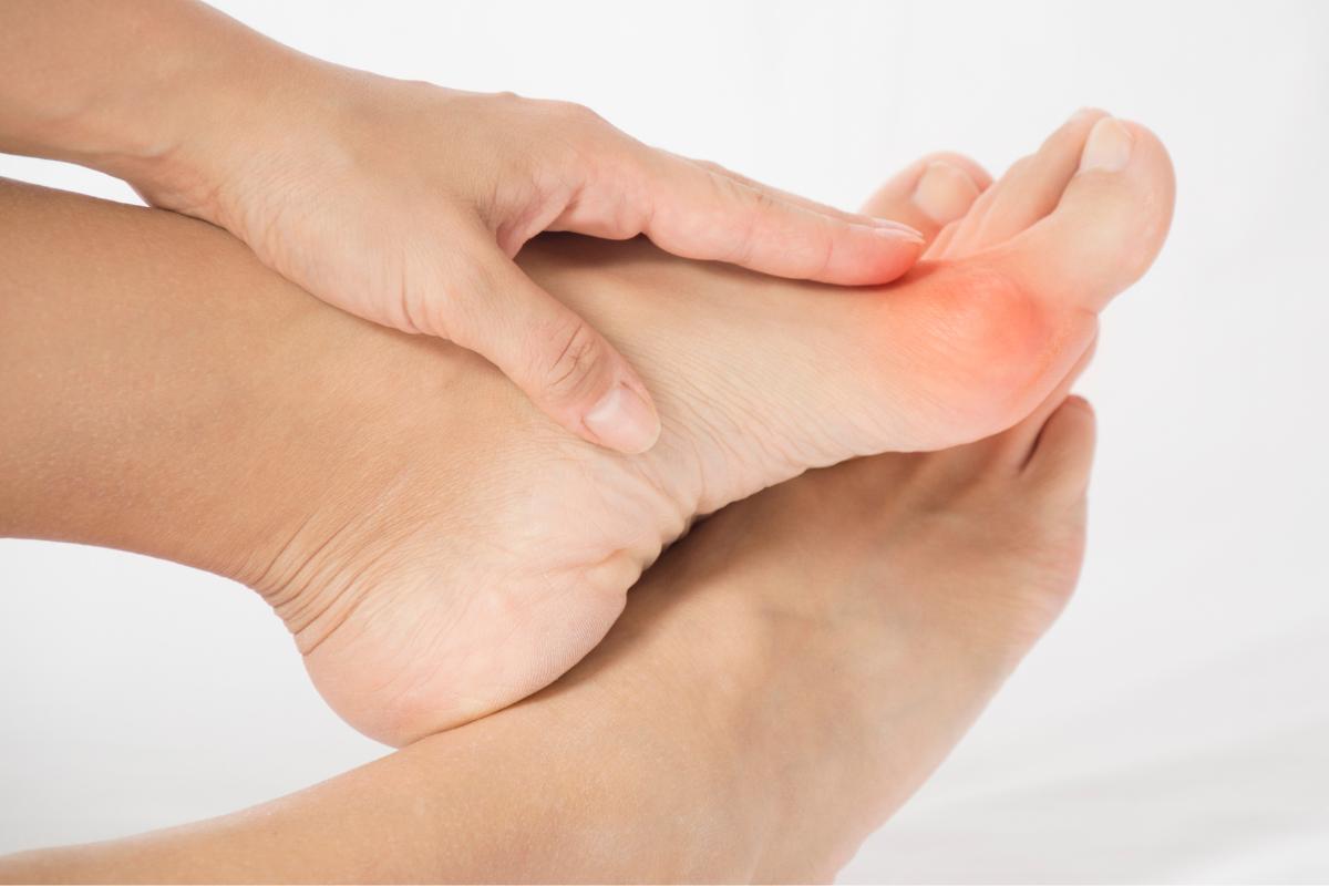 Sabañones en los pies: qué son, causas y cómo curarlos