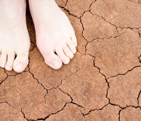 Trucos de belleza con aceite de bebé - Trucos de belleza con aceite de bebé: pies secos o agrietados