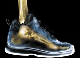 Cuáles son la lesiones más comunes del tenis - Paso 4