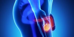 Por qué salen quistes en los testículos