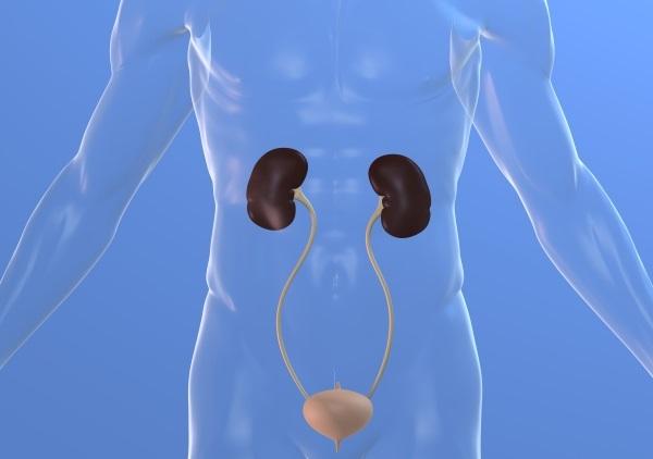 Remedios caseros para los cálculos renales