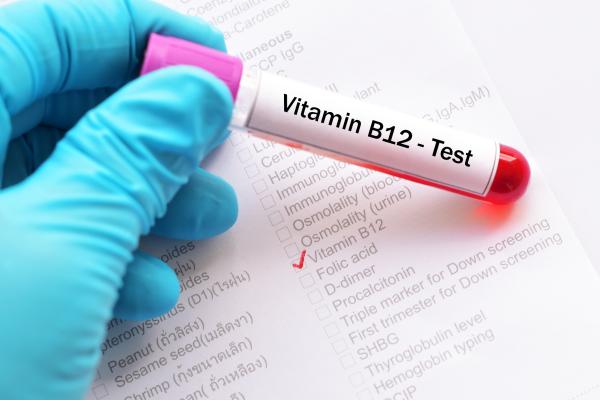 Exceso de vitamina B12: síntomas y cómo eliminarlo - Cómo eliminar el exceso de vitamina B12