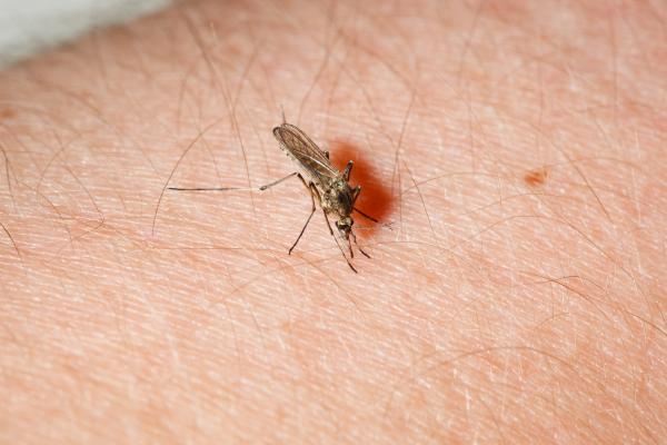 Cómo quitar una reacción alérgica en la piel - Causas de las reacciones alérgicas en la piel