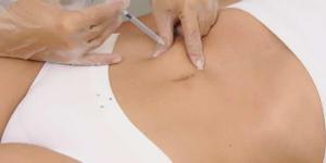 Cómo funciona la mesoterapia