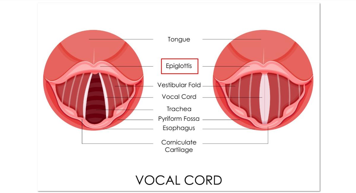 Síntomas de la epiglotitis
