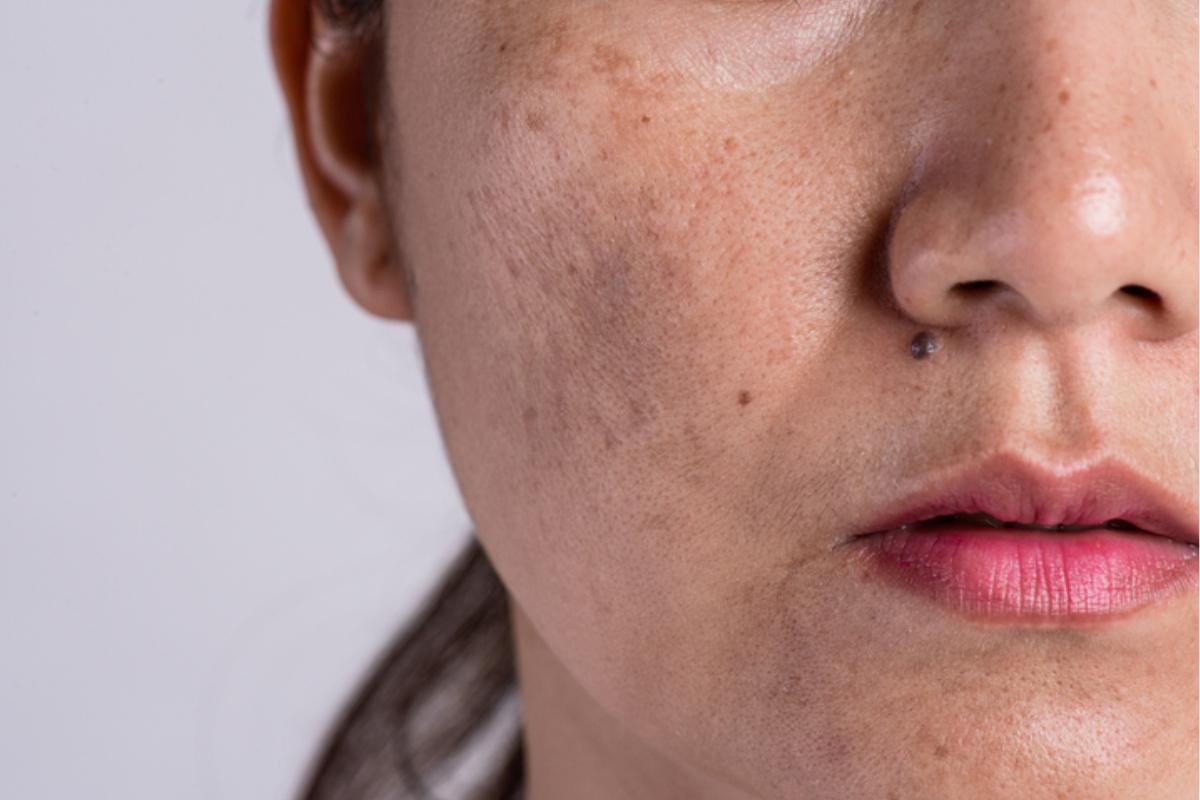 Cómo quitar el paño de la cara