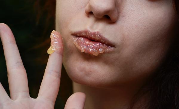 Cómo aumentar los labios - Miel para agrandar los labios de forma natural
