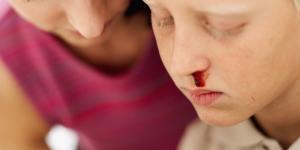 Qué hacer si me sangra la nariz