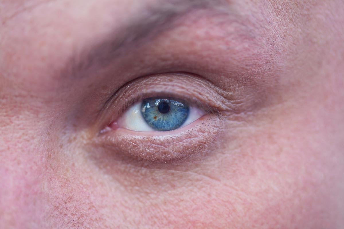 Por qué salen bolsas en los ojos y cómo prevenirlas