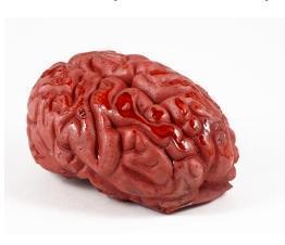 Cómo tratar la congestión cerebral