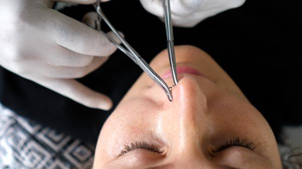 Cuánto tarda en cerrarse el piercing de la nariz - Cuánto tarda en cerrarse el piercing de la nariz ya cicatrizado