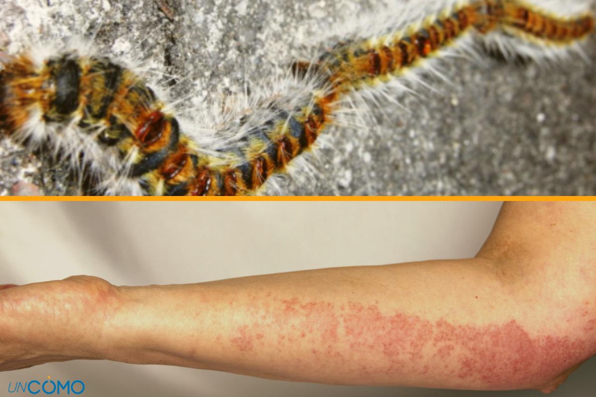 Picadura de oruga procesionaria: síntomas y qué hacer