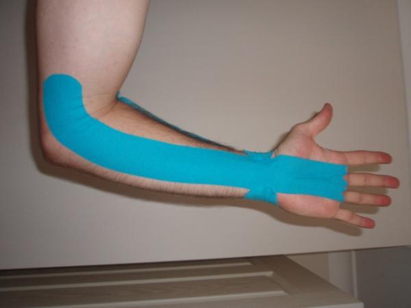 Por qué me duele el codo