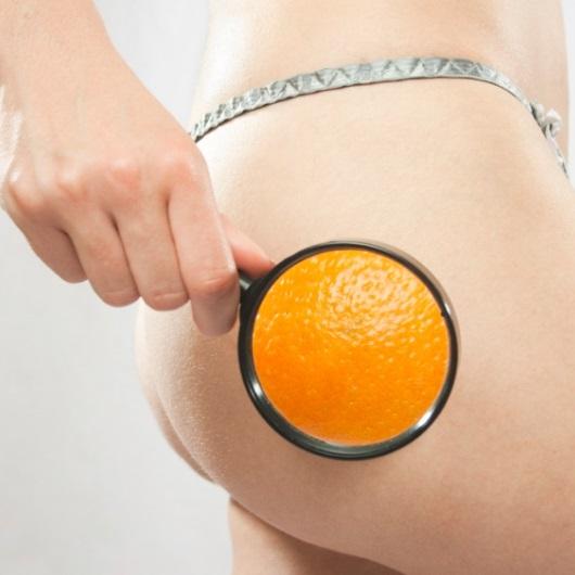 Cómo elegir una crema reductora