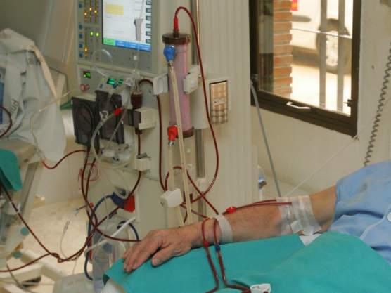 Cuál es la diferencia entre hemodiálisis y diálisis peritoneal