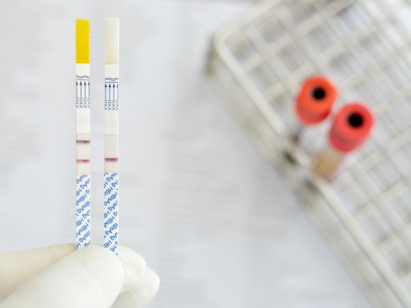 Cuáles son los síntomas de la hepatitis C