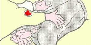 Cómo hacer el método de Holger Nielsen - respiración artificial