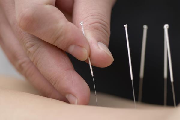 Cómo quitar el dolor de muelas con acupuntura - Acupresión