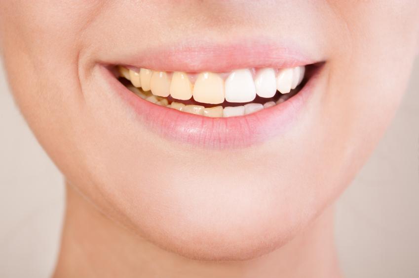 Hábitos para mantener dientes blancos