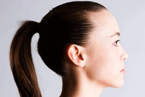 Cómo prevenir la alopecia - Paso 8