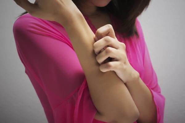 Cómo quitar manchas de la piel por picaduras de insectos