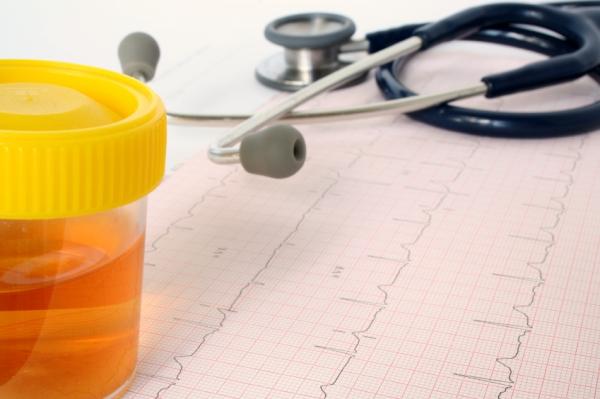 Causas del cólico nefrítico - Paso 4