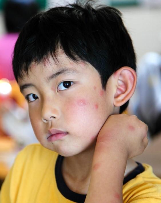 Causas de la parasitosis - Paso 4