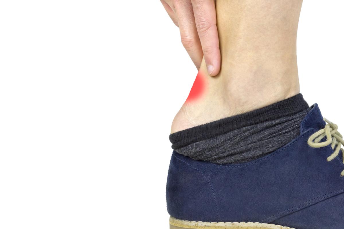 Cómo curar una ampolla abierta