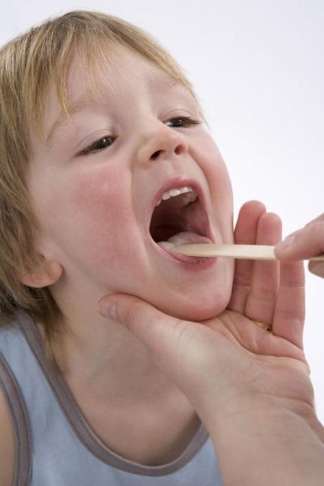 Cómo tratar las paperas