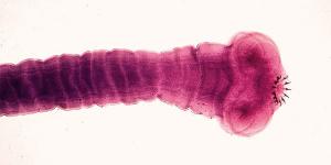 Cómo deshacerse de la Tenia o Solitaria en humanos