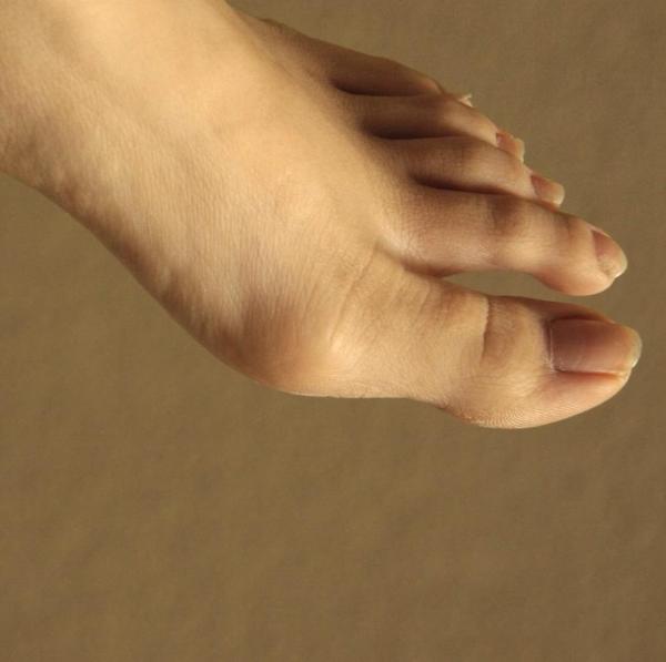 Cómo tratar callos dolorosos